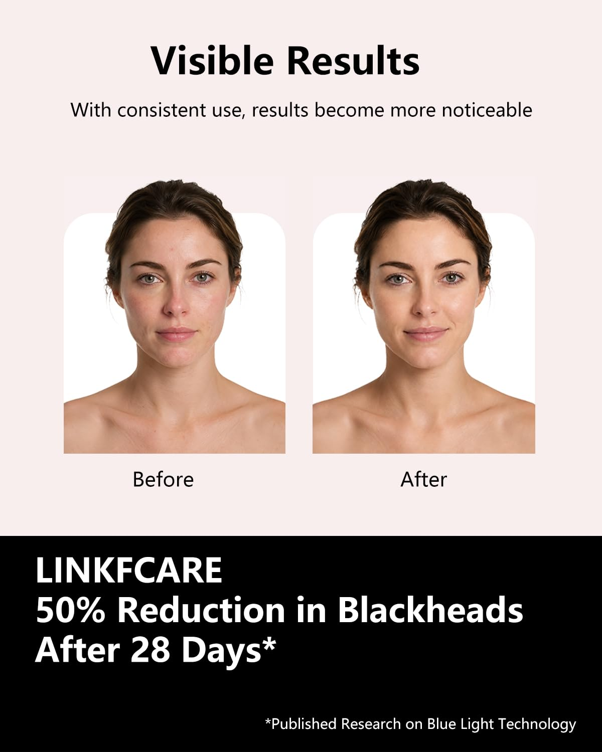7-Color LED Light Therapy Face Mask